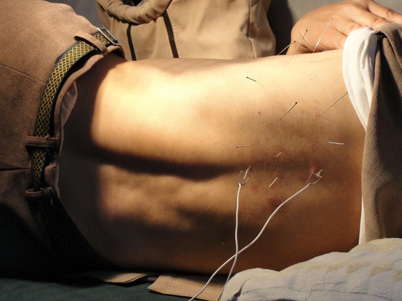 Acupuncturist in Veenendaal